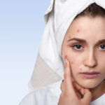 Skincare untuk Wajah Berjerawat