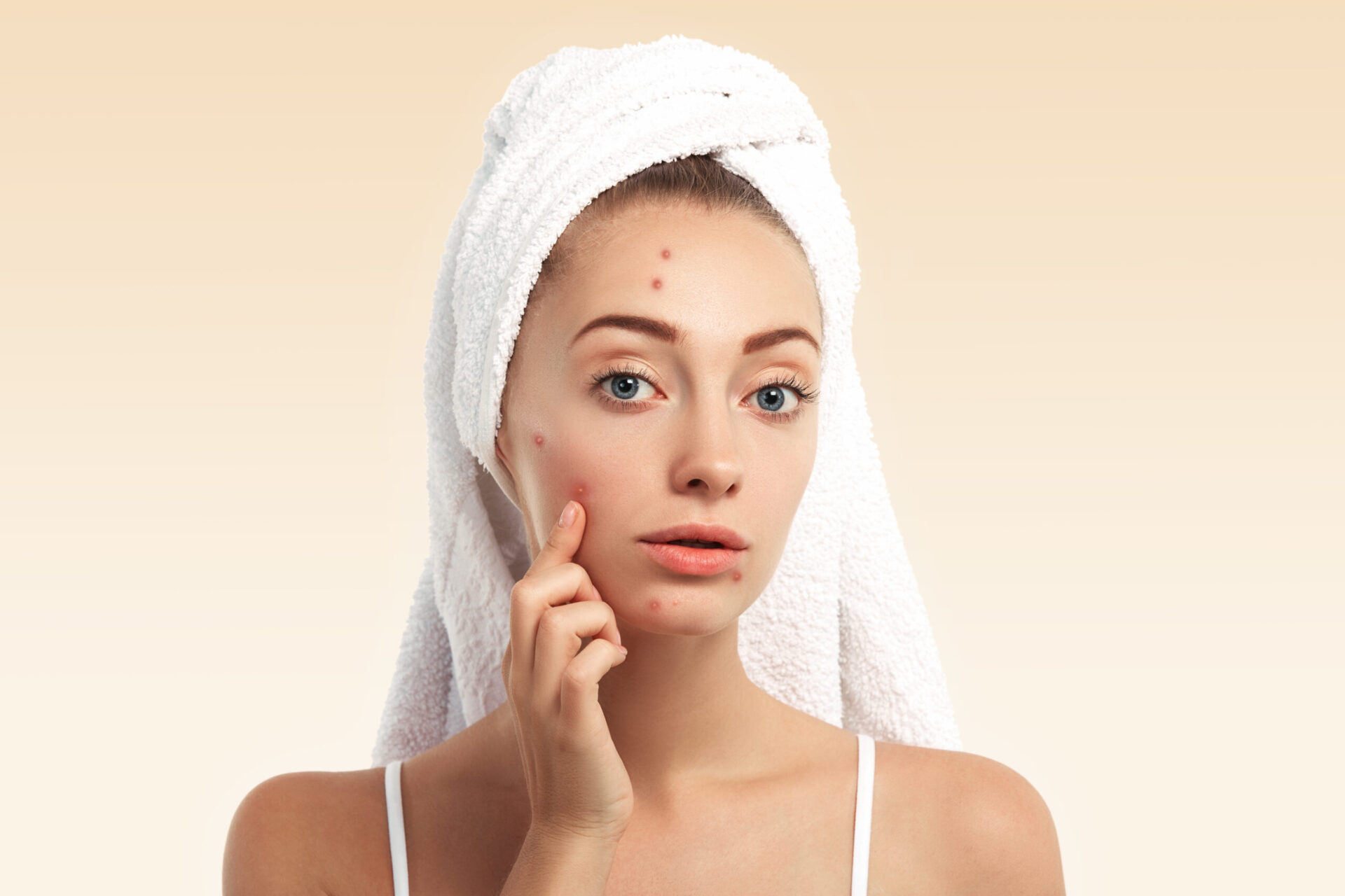 Seperti Apa Urutan Skincare untuk Kulit Berminyak? Ini Penjelasannya
