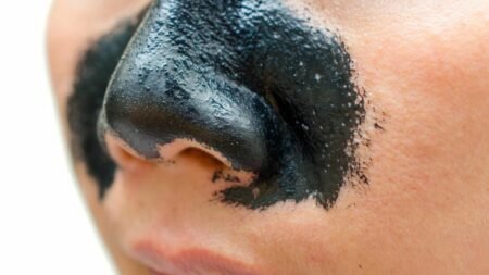 Skincare untuk menghilangkan komedo