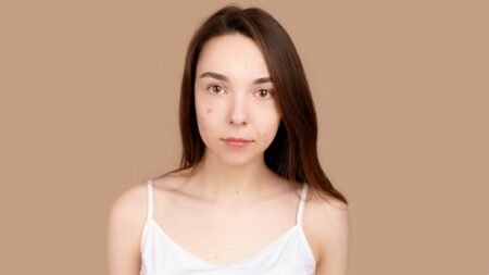 Skincare untuk kulit bruntusan