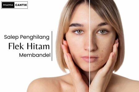 Salep penghilang flek hitam membandel
