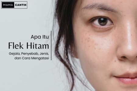 Apa itu flek hitam