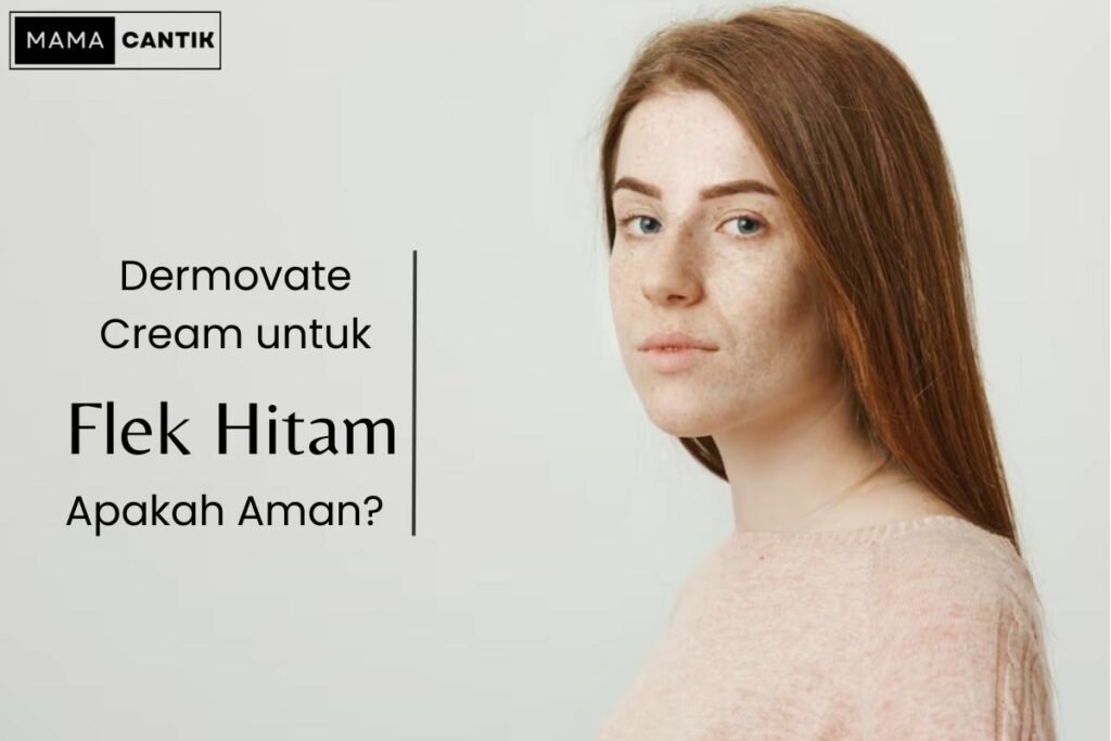 Dermovate cream untuk flek hitam