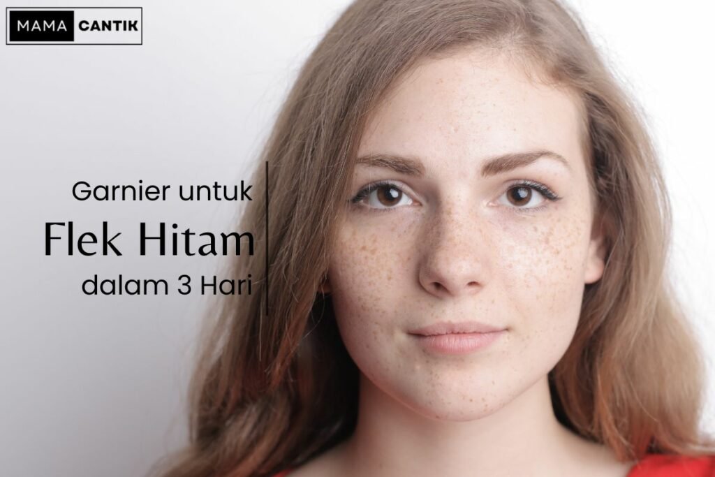 Garnier untuk flek hitam dalam 3 hari