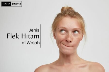 Jenis flek hitam di wajah