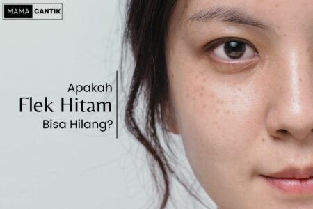 Apakah flek hitam bisa hilang