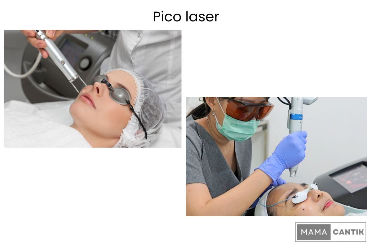 Biaya laser wajah di klinik kecantikan