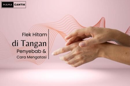 Flek hitam di tangan