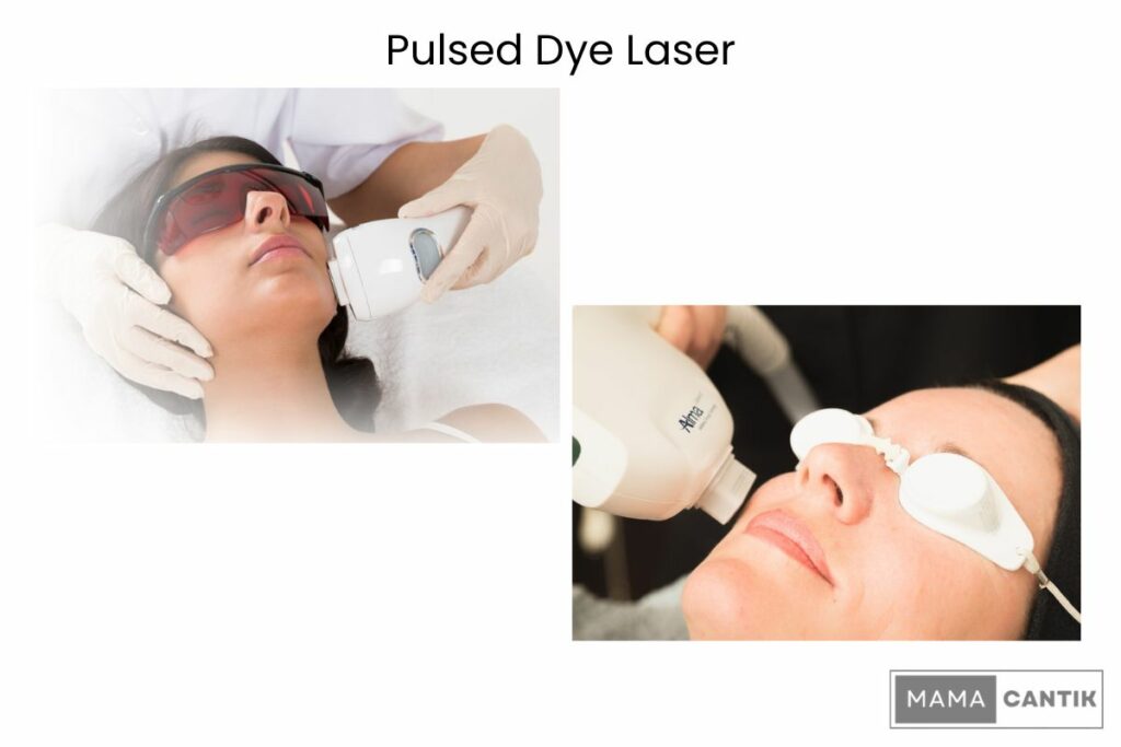 Harga treatment laser wajah