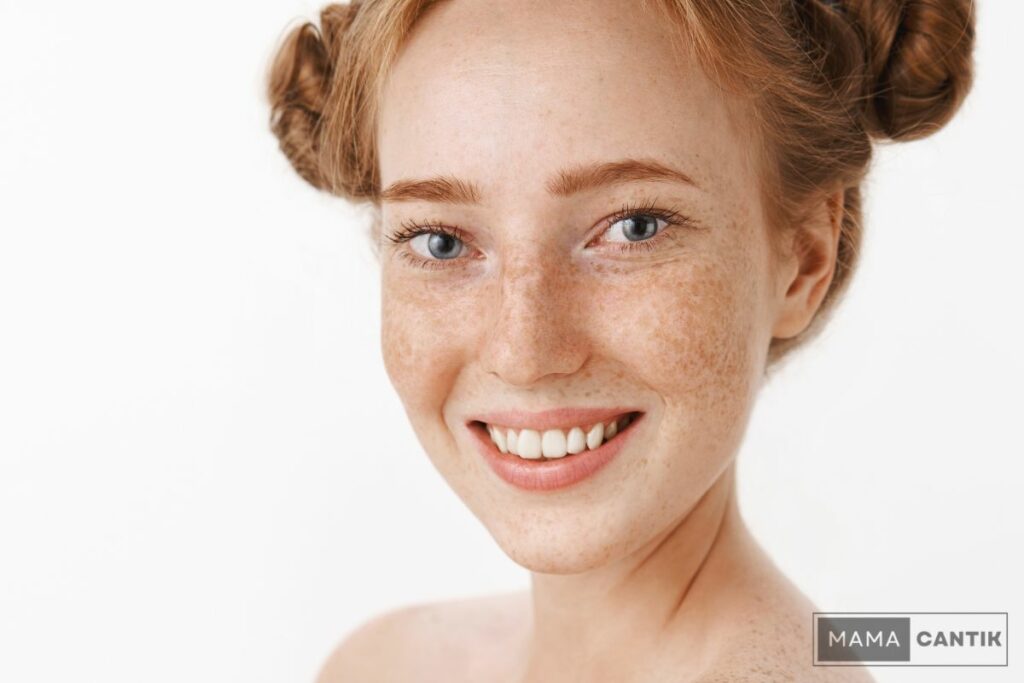 Apakah orang indonesia bisa memiliki freckles