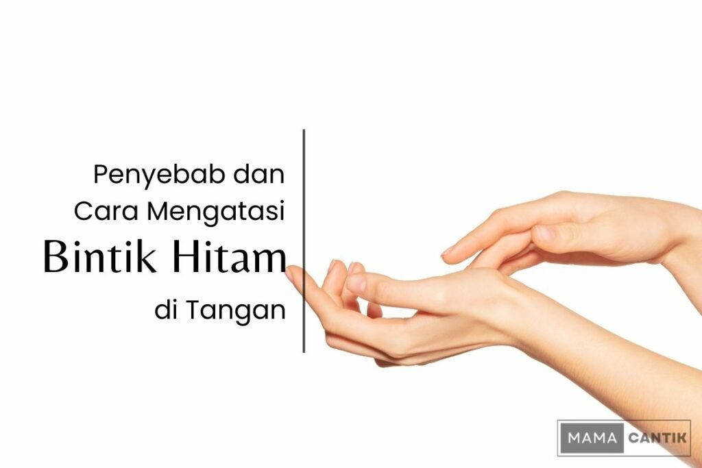 Bintik hitam di tangan