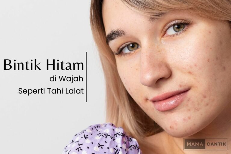 Bintik hitam di wajah seperti tahi lalat