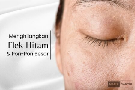 Cara menghilangkan flek hitam dan pori pori besar di wajah