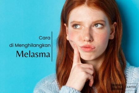 Cara menghilangkan melasma