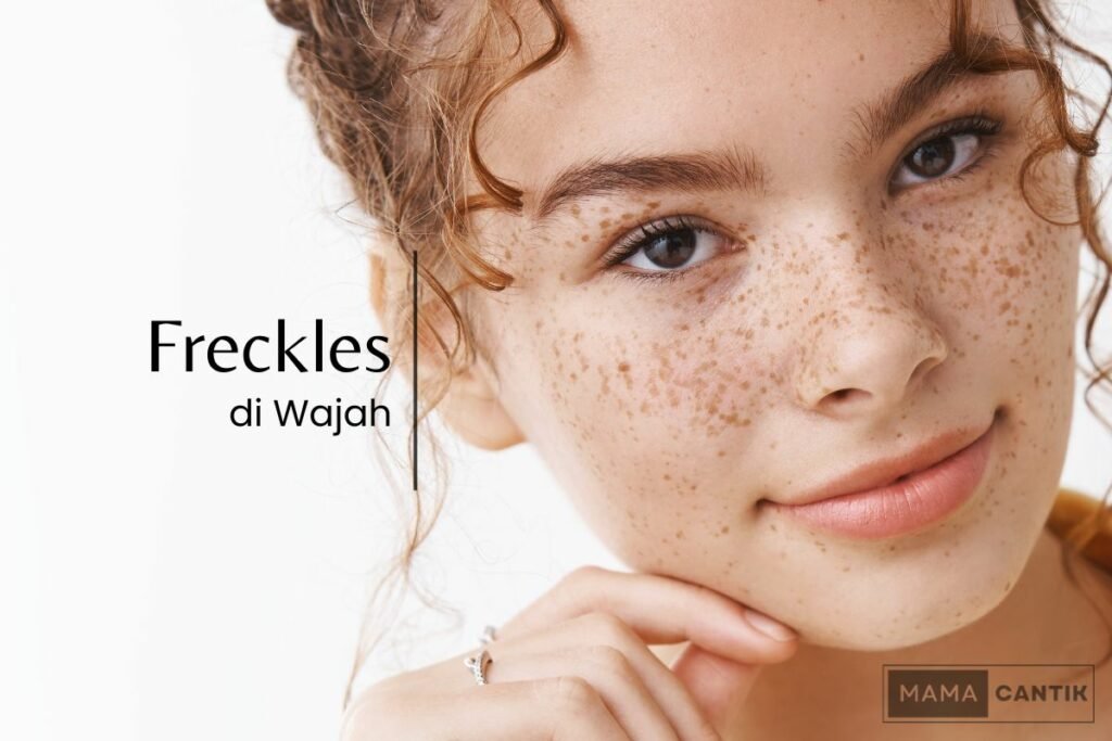 Freckles di wajah