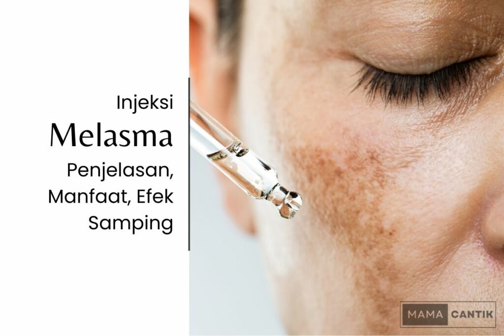 Injeksi melasma