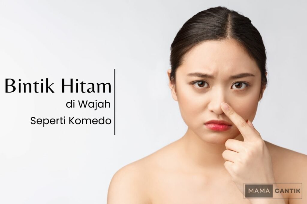 Bintik hitam di wajah seperti komedo