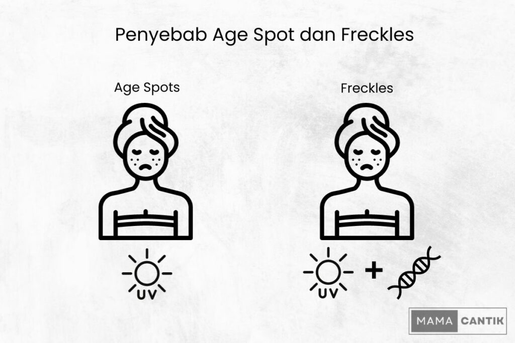 Penyebab age spot vs freckles