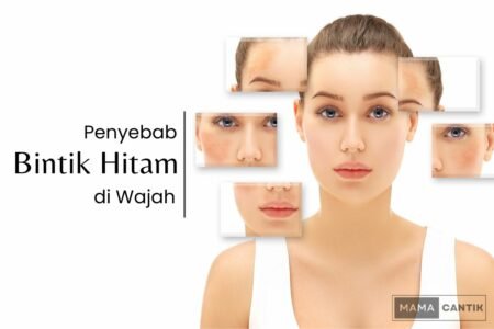 Penyebab bintik hitam di wajah