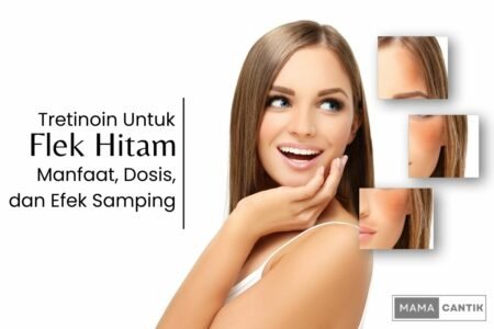 Tretinoin untuk flek hitam