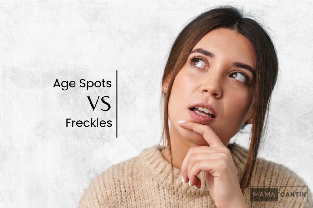 Age spots vs freckles