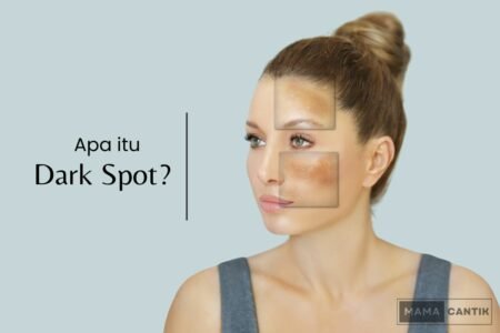 Apa itu dark spot