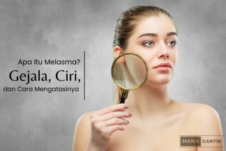 Apa itu melasma