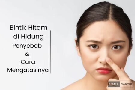 Bintik hitam di hidung