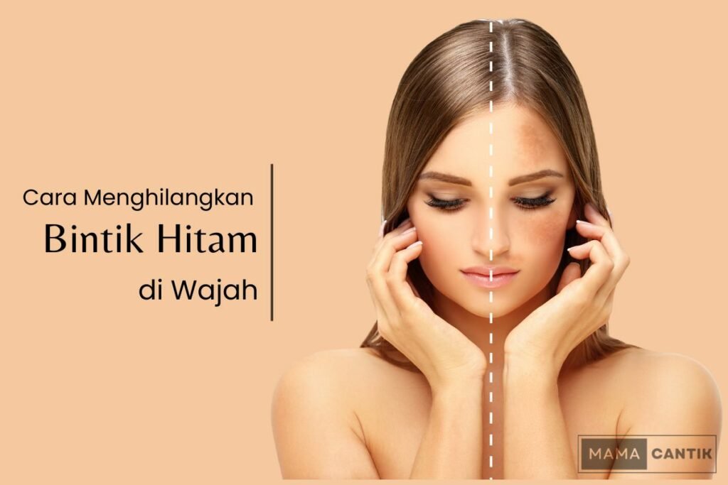 Cara menghilangkan bintik hitam di wajah