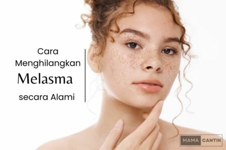 Cara menghilangkan melasma secara alami