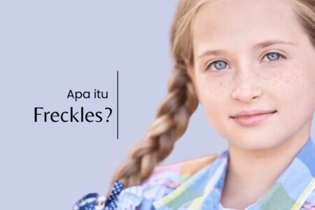 Freckles adalah