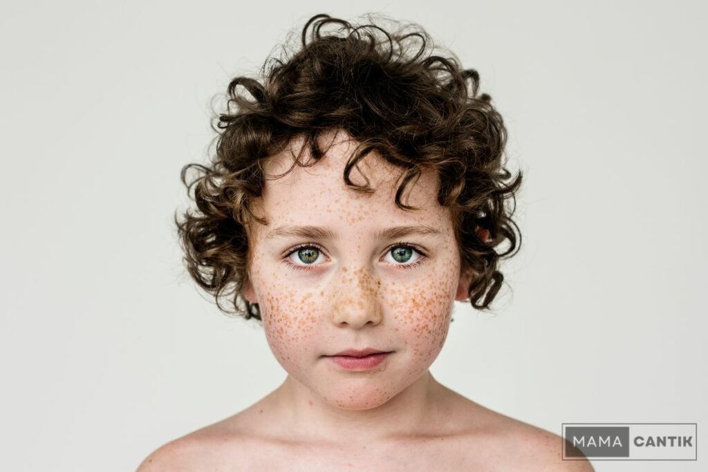 Freckles pada anak kecil