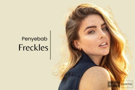 Penyebab freckles