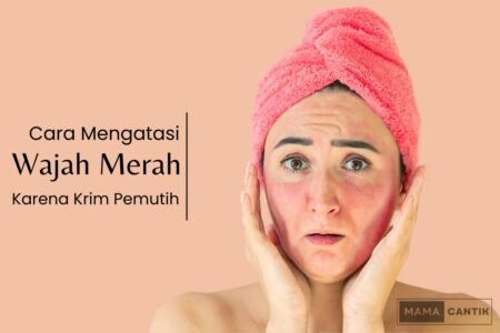Cara mengatasi wajah merah karena cream pemutih