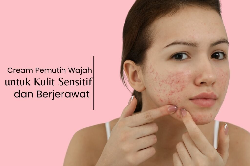 Cream pemutih wajah untuk kulit sensitif dan berjerawat