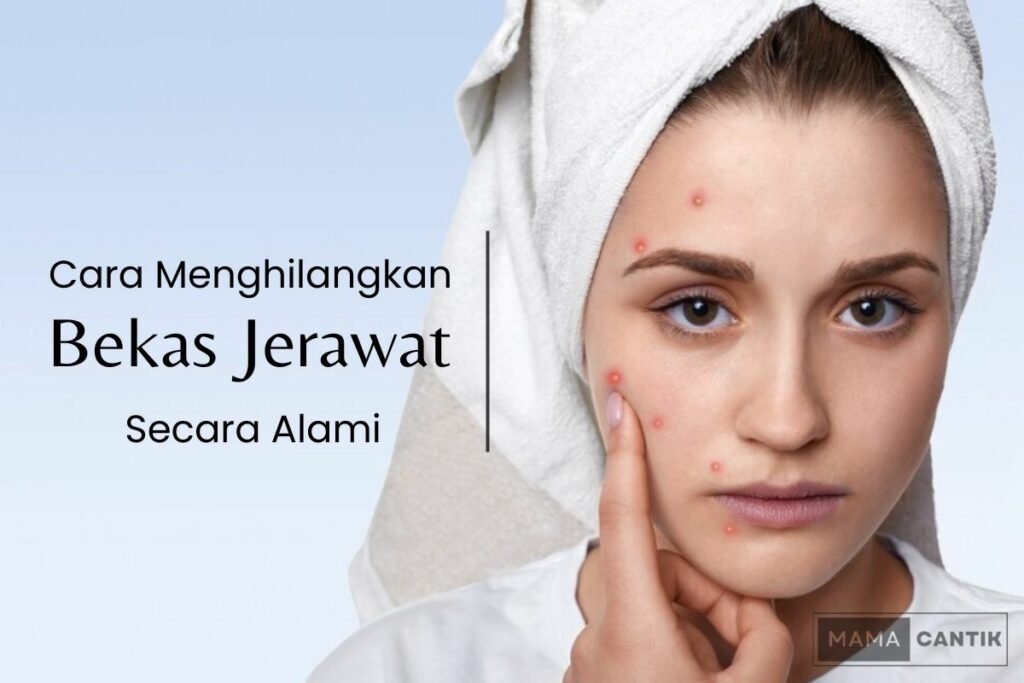 Cara menghilangkan bekas jerawat secara alami