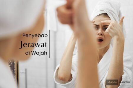 Penyebab jerawat