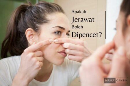 Apakah jerawat boleh dipencet