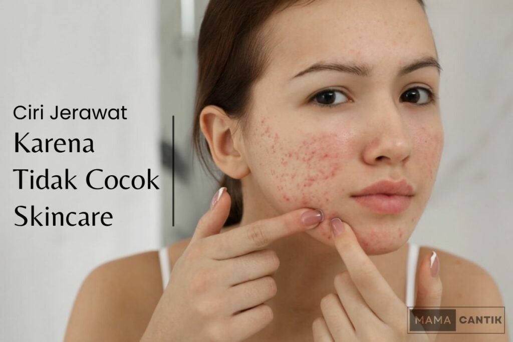 Ciri jerawat karena tidak cocok skincare