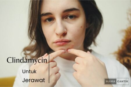 Clindamycin untuk jerawat