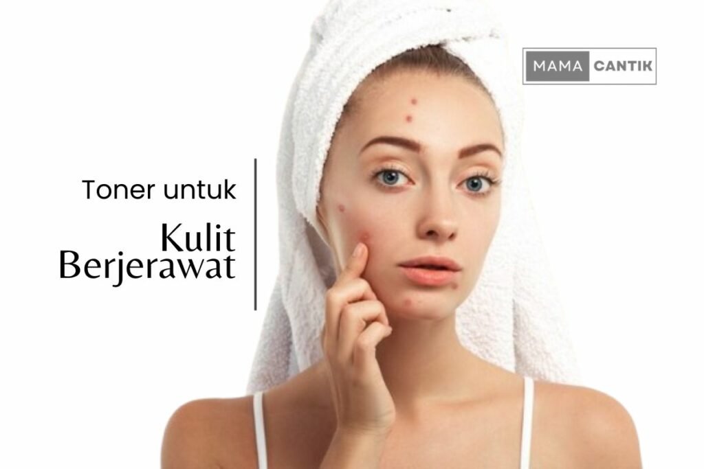 Toner untuk kulit berjerawat