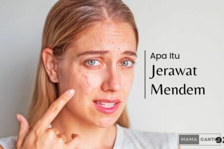 Jerawat mendem