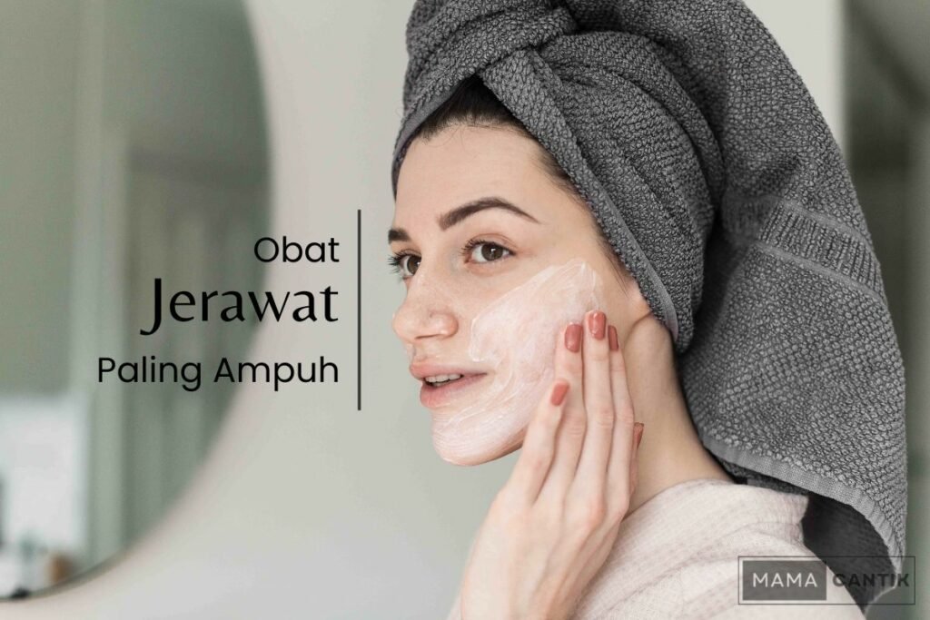 Obat jerawat paling ampuh